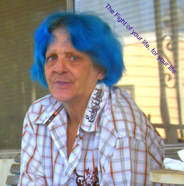 Blue Hair in Defiance of Colon Cancer