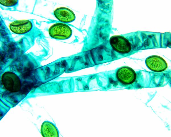 Flickr is a search engine