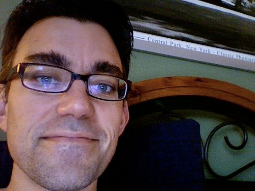 Cancer Treatment: Day 86 (Chemoradiotherapy Day 16)