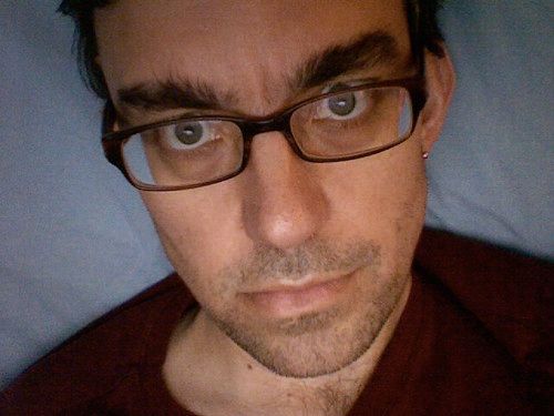 Cancer Treatment: Day 103 (Chemoradiotherapy Day 33)