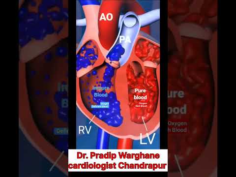 #heart#cardio #cardiologist