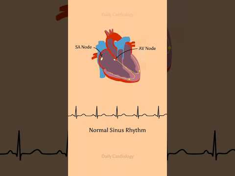 ECG rhythm with conduction pathways (Normal sinus rhythm, atrial fibrillation &amp; atrial flutter) #ecg