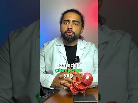 YAĞ BEZELERİ NASIL GEÇER ? #yağbezesi #yağ